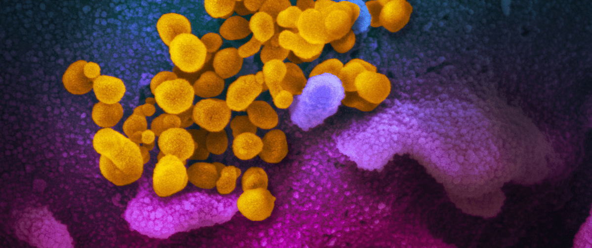 COVID-19 in a Parallel&nbsp;Universe